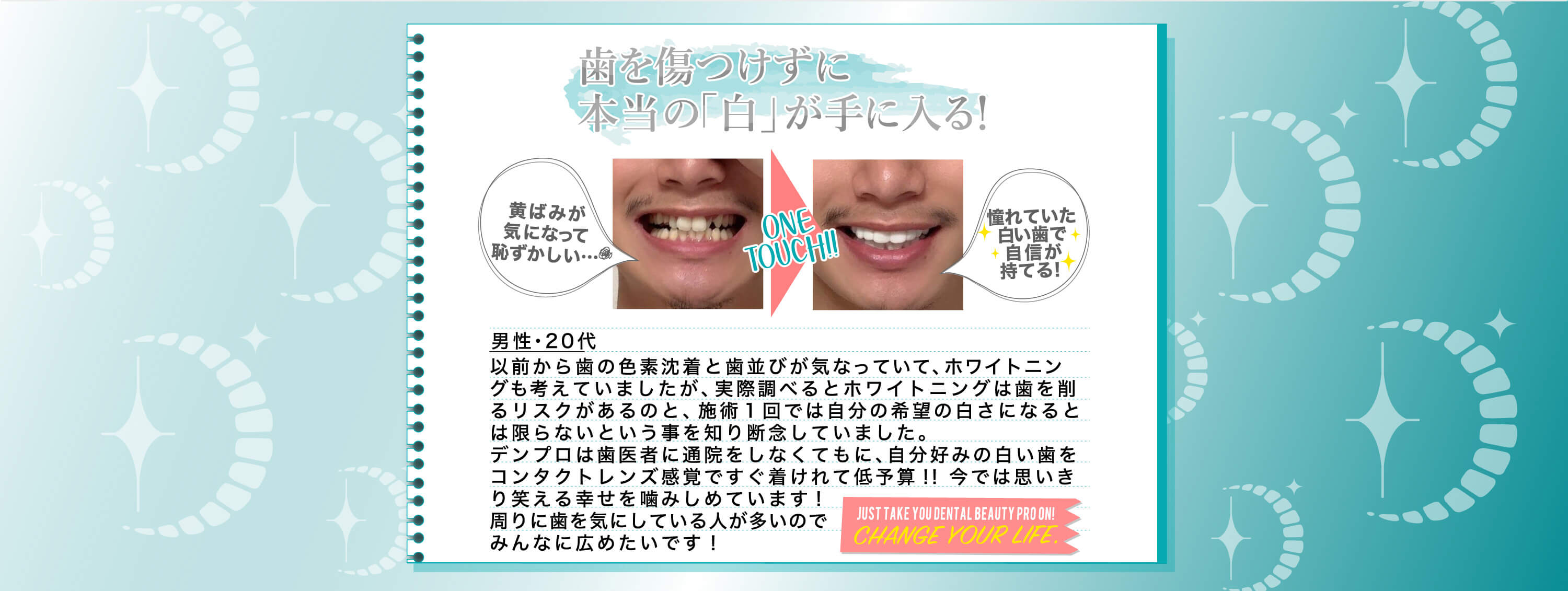 歯を傷つけずに本当の「白」が手に入る！